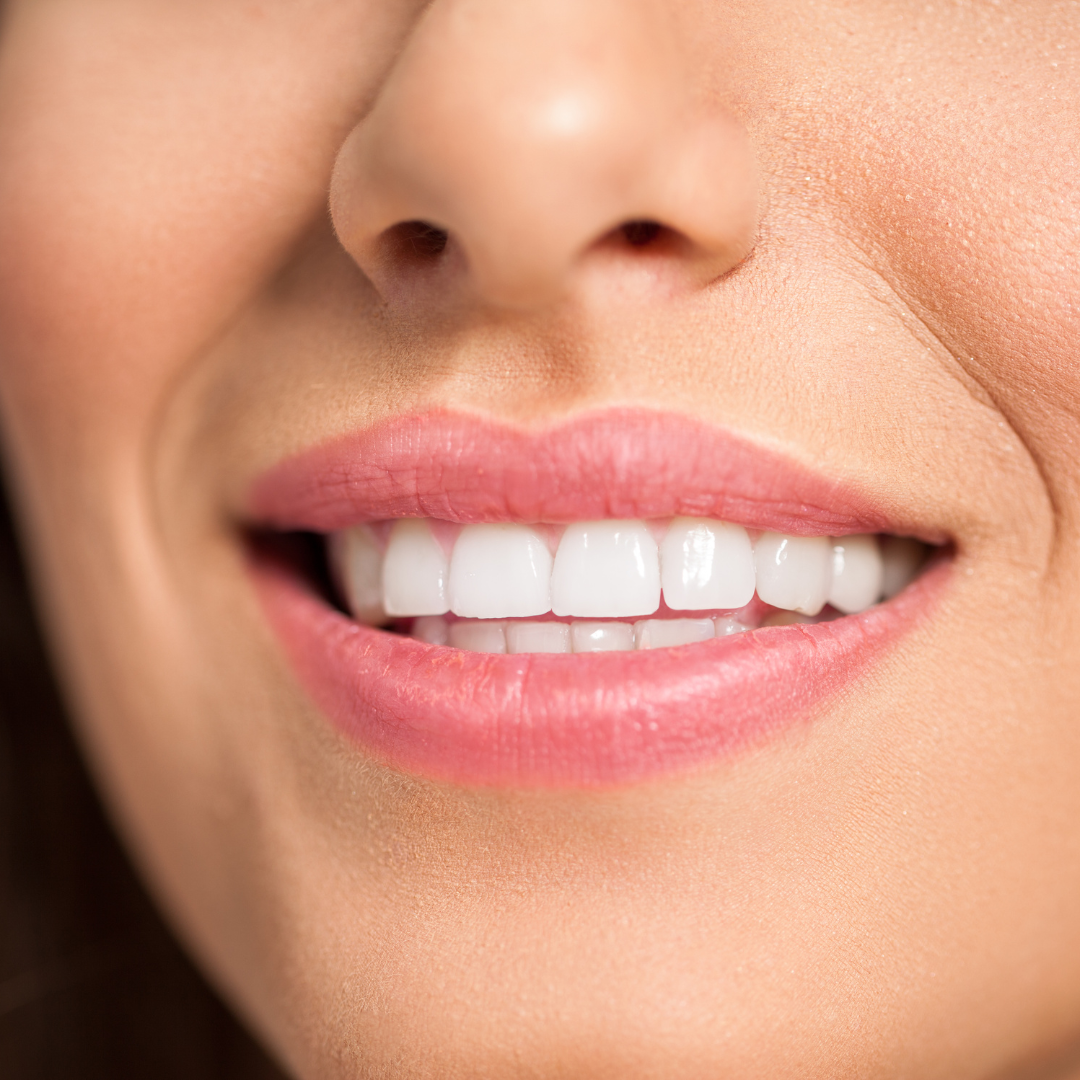 How can dental implants transform your smile?